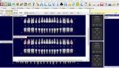 Dental4windows programos 3D dantų grafikas ne tik patogus įrankis matyti e…