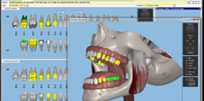 Dental4windows (D4W) programa – skirta odontologijos klinikų praktikai ir kasdi…