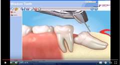 Pacientų konsultacijoms skirtas xPlain modulis Dental4windows programoje: