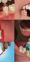 Dental4windows xPlain/CiC Pro modulis – kad pacientus konsultuoti būtų pap…